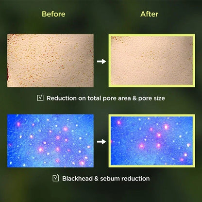 PureGlow Skincare Essentials Set