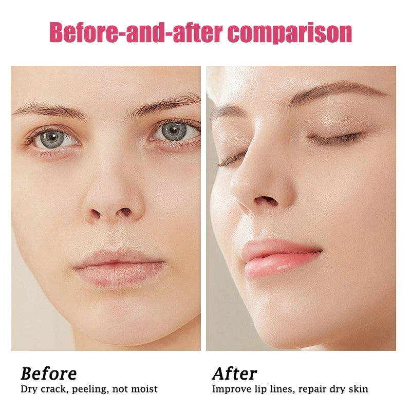 Multi-Flavor Hydrating Lip Balm Set – Moisture & Care for All